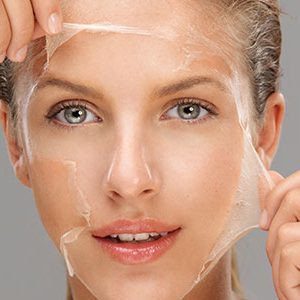 Chemical Peel