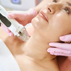 Microneedling - Neck-Add On